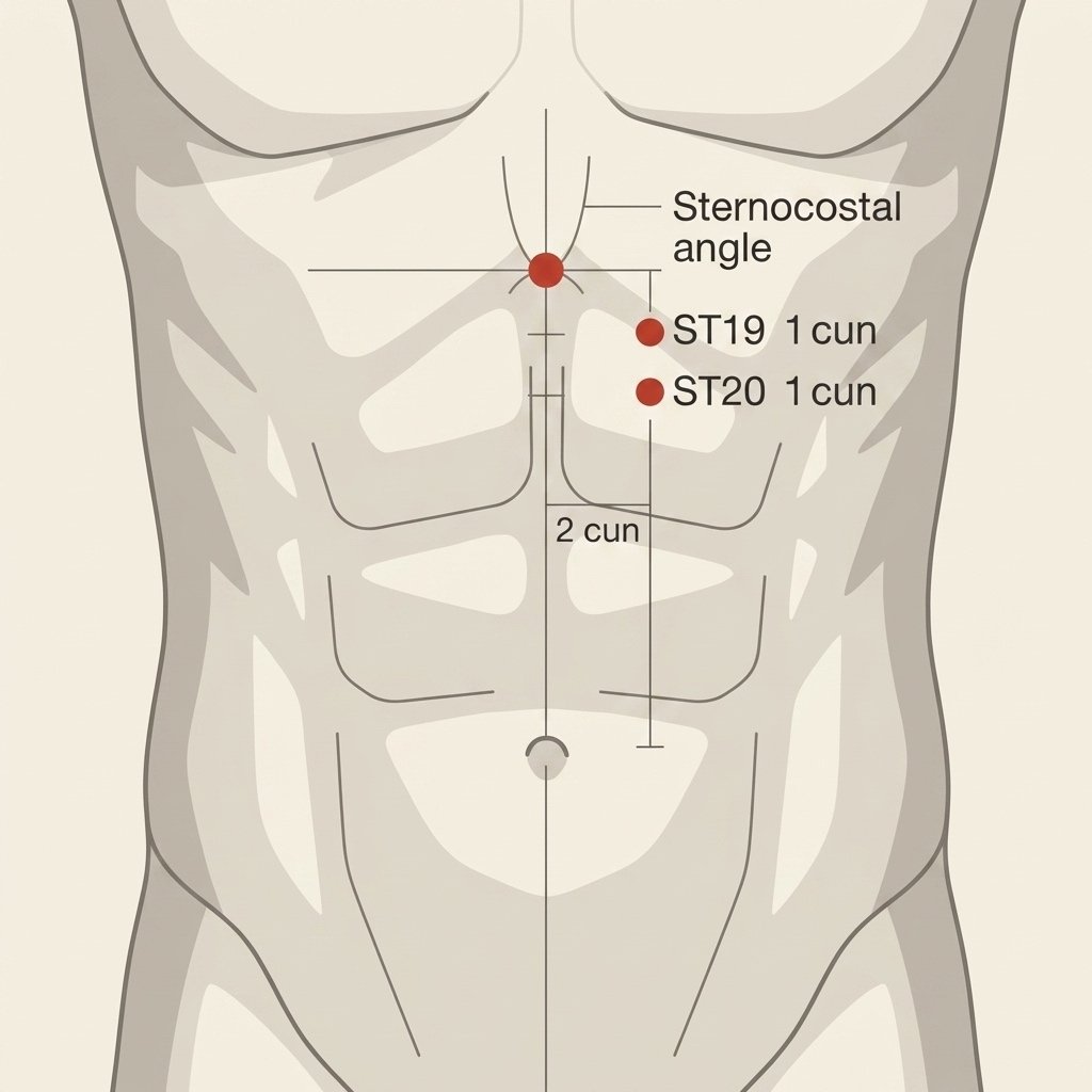 ST-20 Chengman