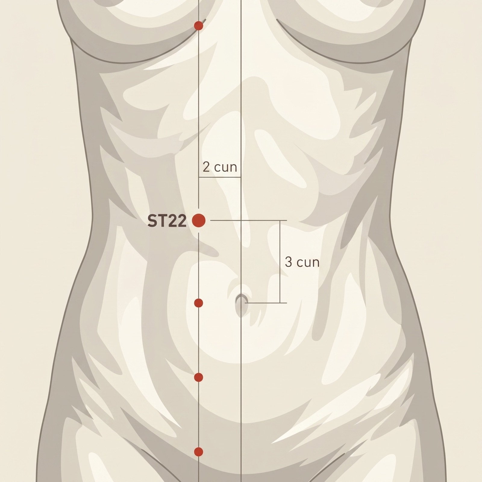 ST-22 Guanmen