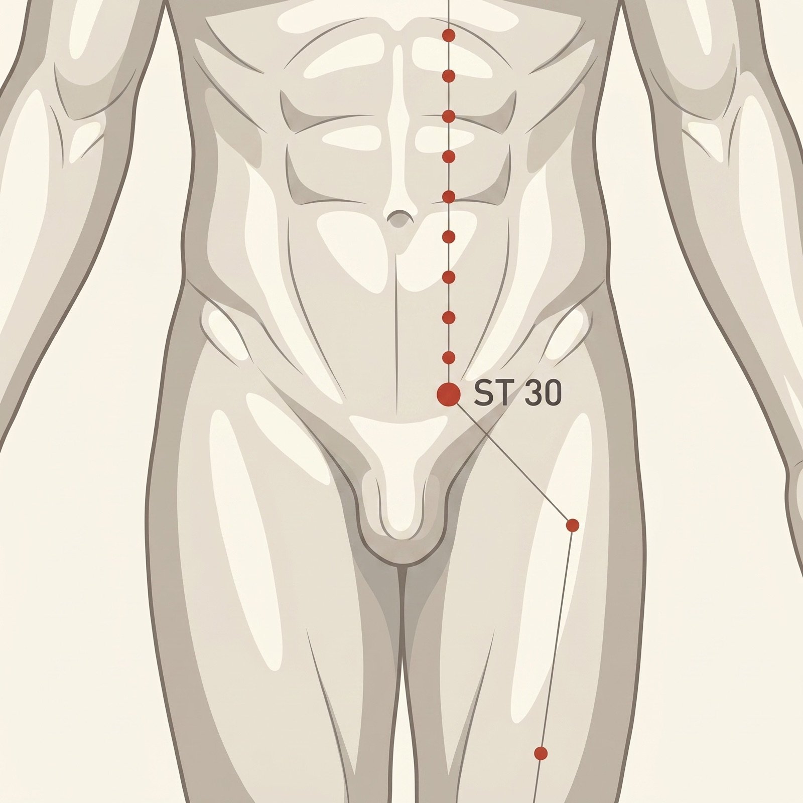 ST-30 Qichong