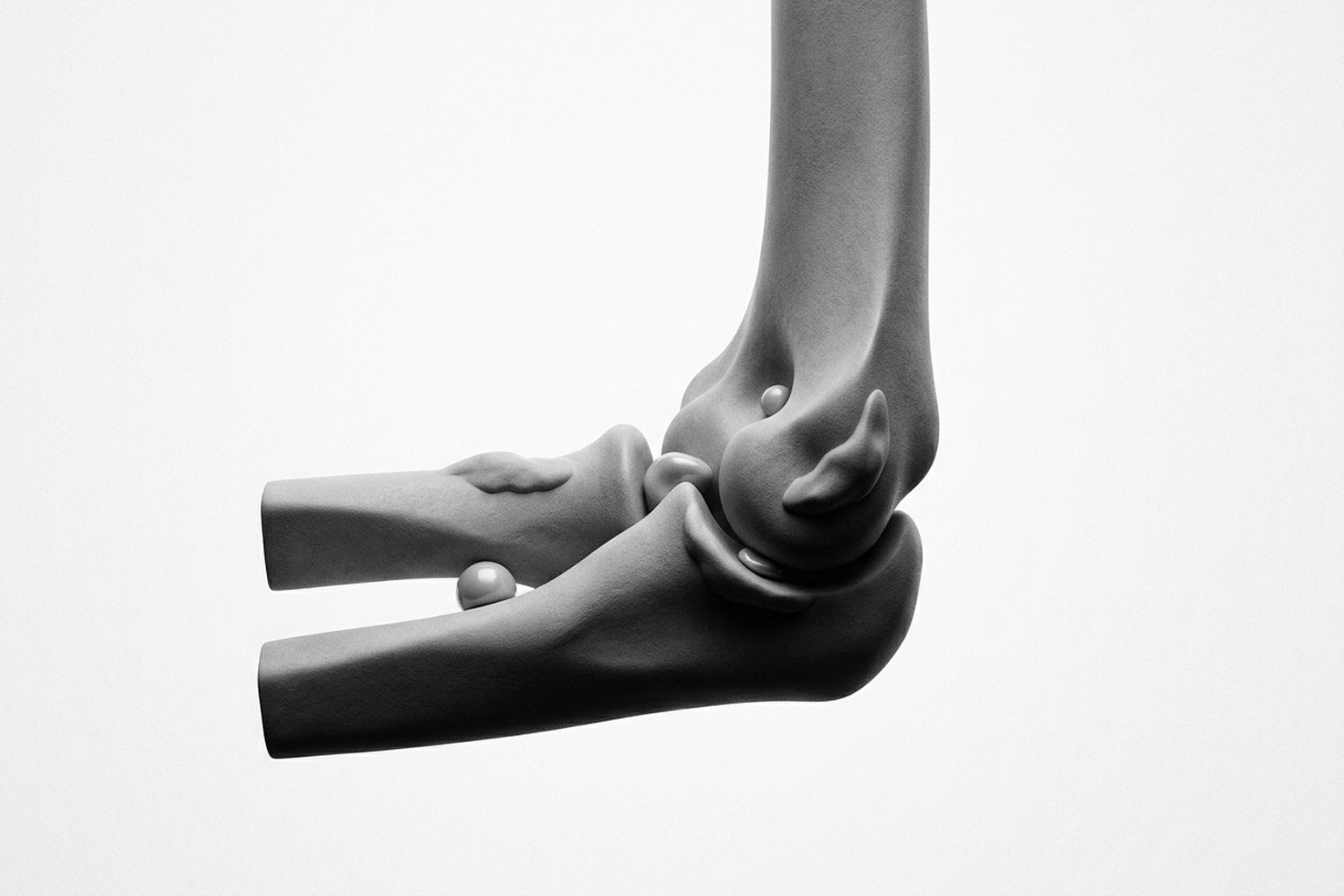 Anatomía del codo: articulación húmero-cubital, húmero-radial y radio-cubital proximal; sitios de formación de osteofitos en la fosa olecraneana y coronoidea; cuerpos libres articulares