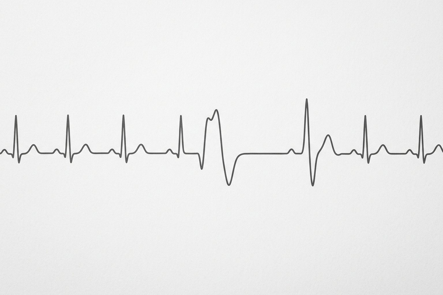 Palpitações Benignas