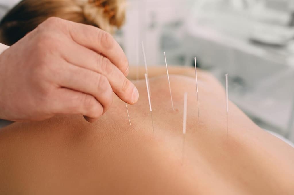 acupuntura medica sao paulo15